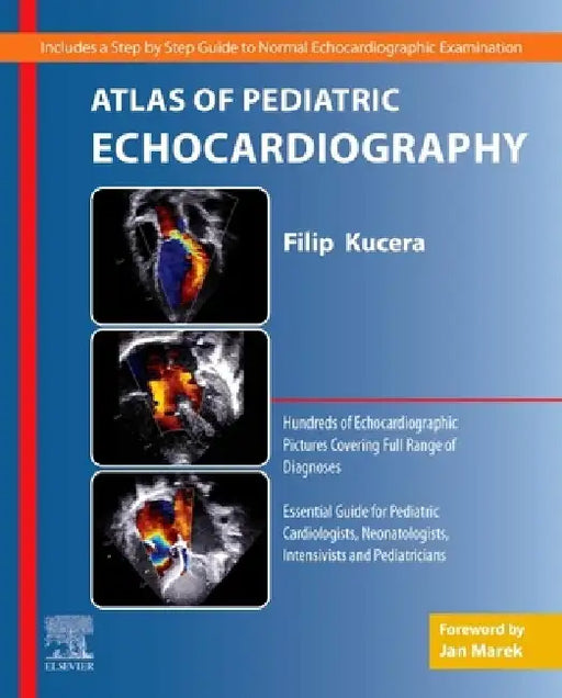 Atlas of Pediatric Echocardiography by Filip Kucera