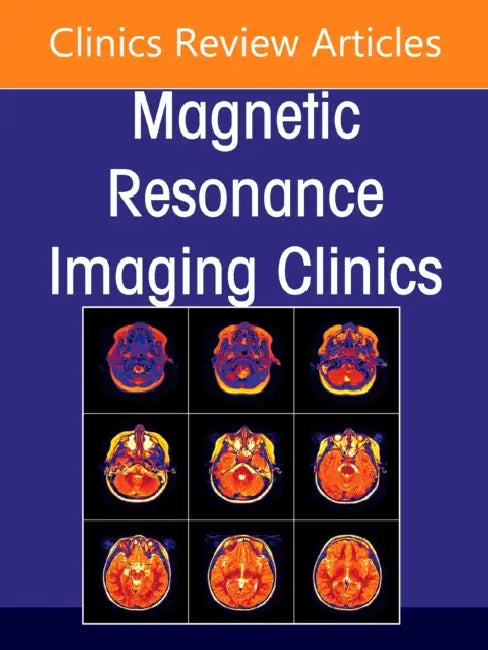 Advances in Diffusion-Weighted Imaging, an Issue of Magnetic Resonance Imaging Clinics of North America: Volume 29-2 by Kei Yamada