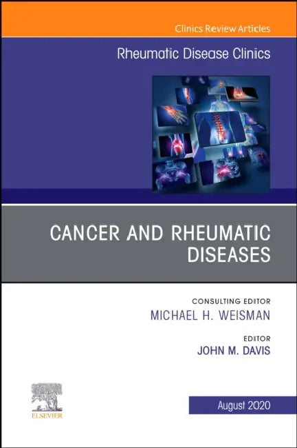 Cancer and Rheumatic Diseases, an Issue of Rheumatic Disease Clinics of North America: Volume 46-3 by John Davis