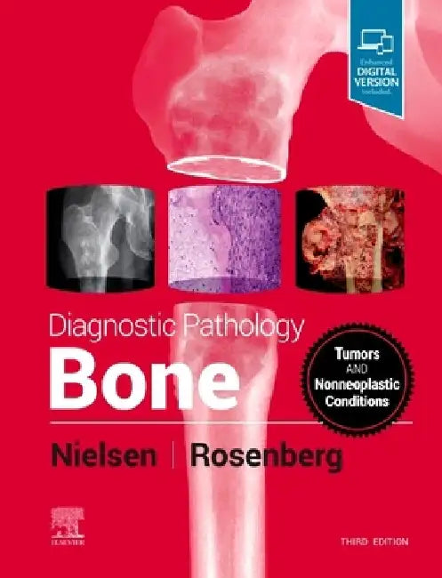 Diagnostic Pathology: Bone by Gunnlaugur Petur Nielsen
