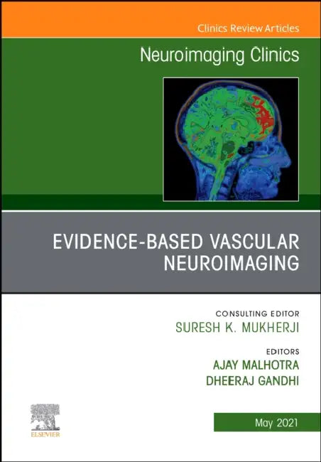 Evidence-Based Vascular Neuroimaging, an Issue of Neuroimaging Clinics of North America: Volume 31-2 by Ajay Malhotra, Dheeraj Gandhi