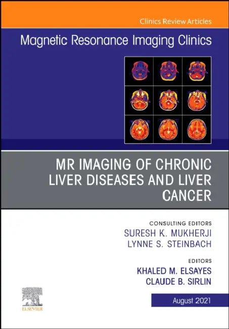 MR Imaging of Chronic Liver Diseases and Liver Cancer, an Issue of Magnetic Resonance Imaging Clinics of North America: Volume 29-3 by Khaled M. Elsayes, Claude Sirlin