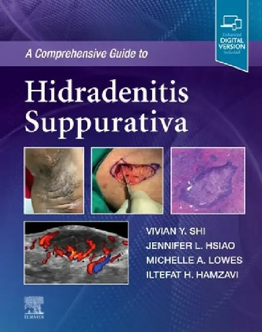 A Comprehensive Guide to Hidradenitis Suppurativa by Vivian Y. Shi