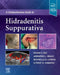 A Comprehensive Guide to Hidradenitis Suppurativa by Vivian Y. Shi