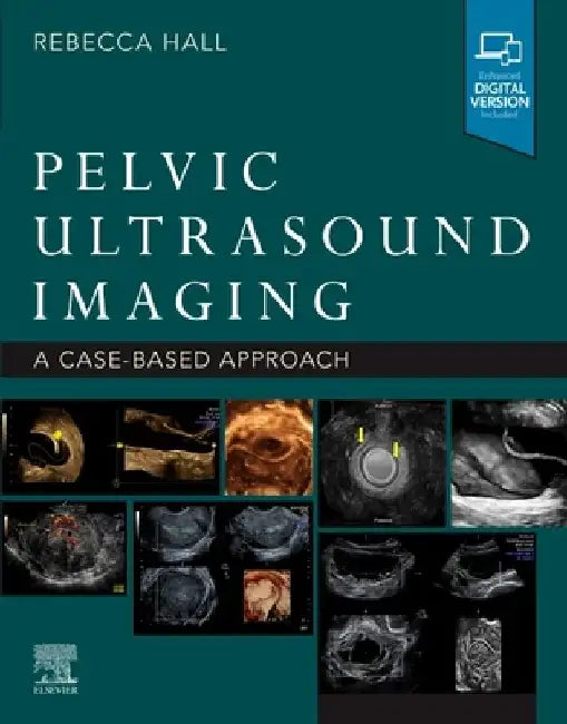 Pelvic Ultrasound Imaging: A Cased-Based Approach by Rebecca Hall