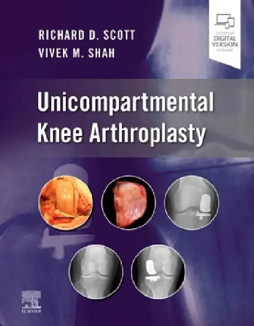 Unicompartmental Knee Arthroplasty by Richard D. Scott
