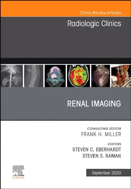 Renal Imaging, an Issue of Radiologic Clinics of North America: Volume 58-5 by Steven C. Eberhardt, Steven Raman