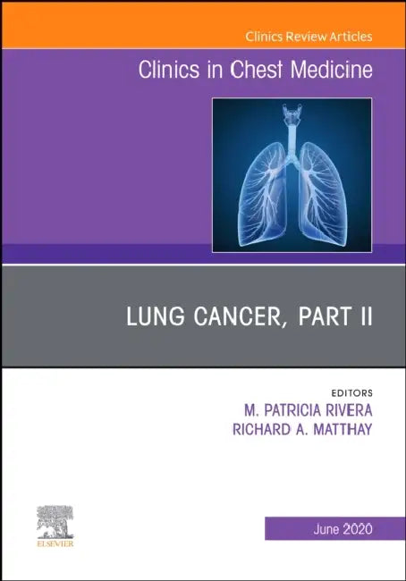 Lung Cancer, Part II, an Issue of Clinics in Chest Medicine: Volume 41-2 by M. Patricia Rivera, Richard A. Matthay