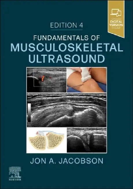 Fundamentals of Musculoskeletal Ultrasound by Jon A. Jacobson