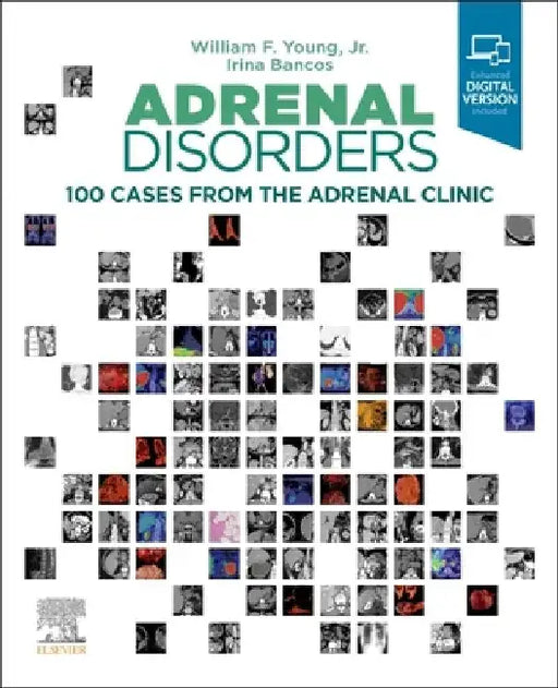 Adrenal Disorders: 100 Cases from the Adrenal Clinic by William F. Young