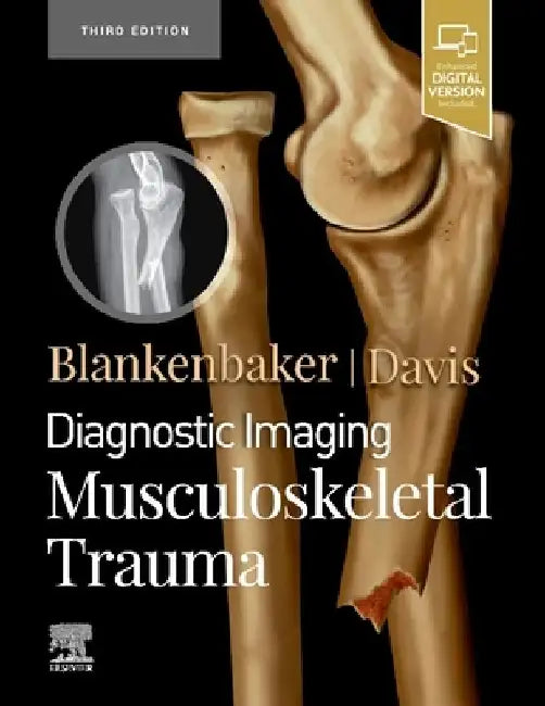 Diagnostic Imaging: Musculoskeletal Trauma by Donna G. Blankenbaker