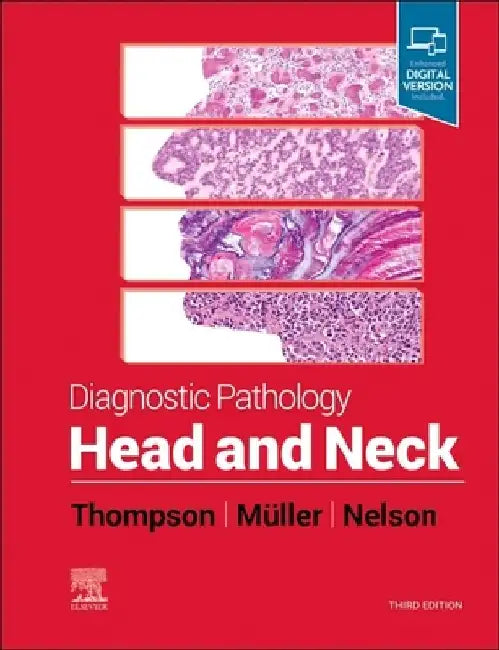 Diagnostic Pathology: Head and Neck by Lester D. R. Thompson