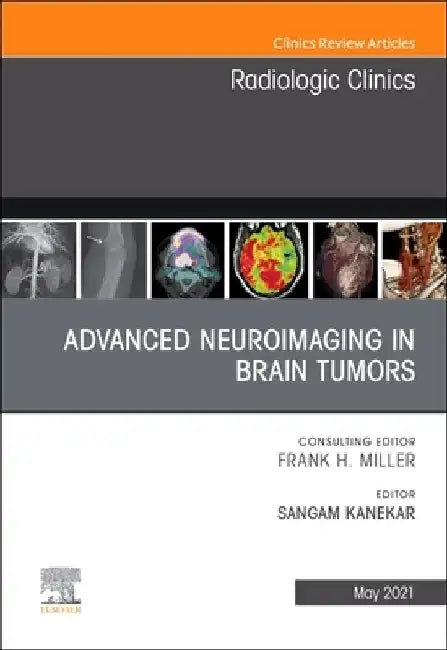 Advanced Neuroimaging in Brain Tumors, an Issue of Radiologic Clinics of North America, Volume 59-3 by Sangam Kanekar