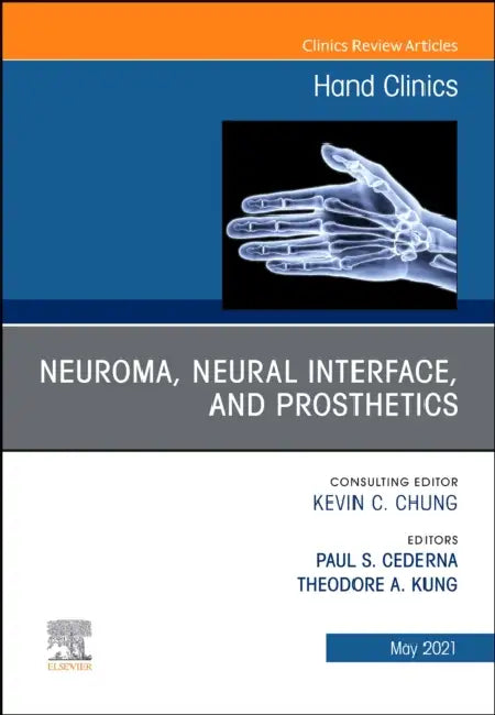 Neuroma, Neural Interface, and Prosthetics, an Issue of Hand Clinics: Volume 37-3 by Paul Stephen Cederna, Theodore A. Kung
