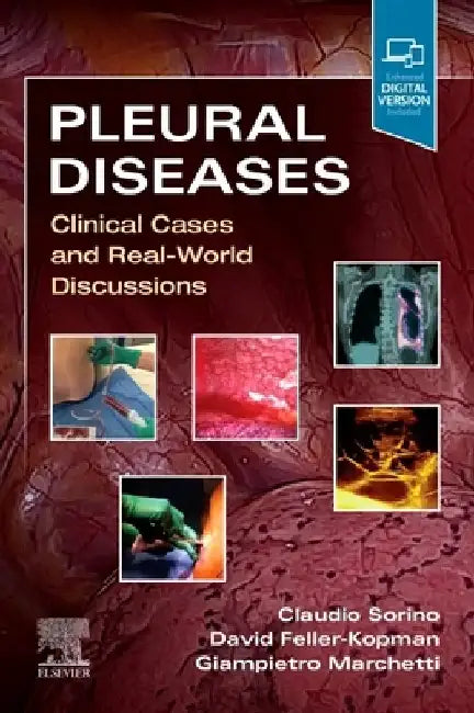 Pleural Diseases: Clinical Cases and Real-World Discussions by Claudio Sorino