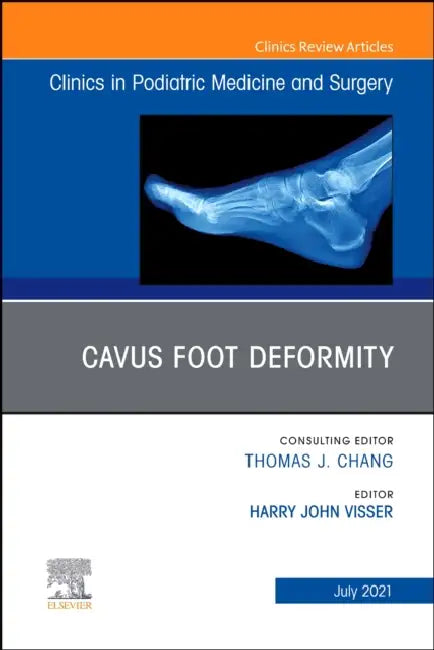 Cavus Foot Deformity, an Issue of Clinics in Podiatric Medicine and Surgery: Volume 38-3 by H. John Visser