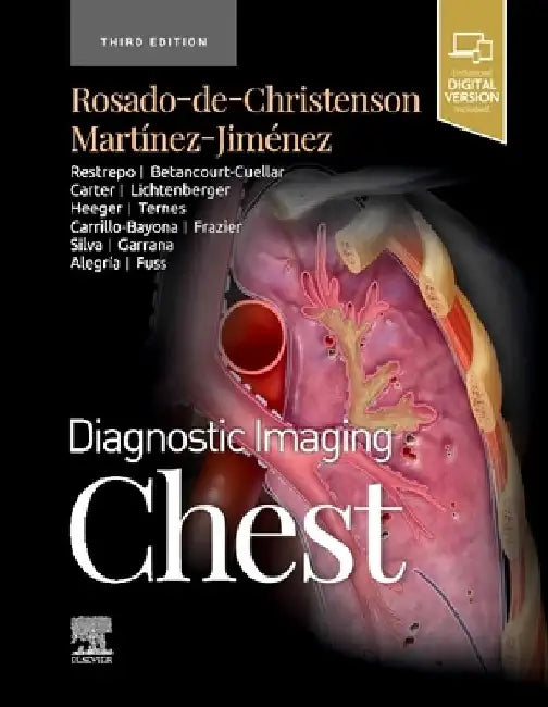 Diagnostic Imaging: Chest by Melissa L. Rosado-De-Christenson