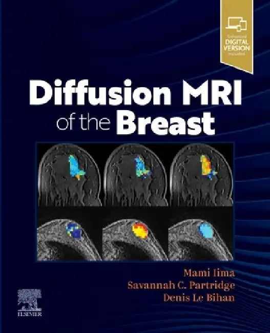 Diffusion MRI of the Breast by Mami Iima