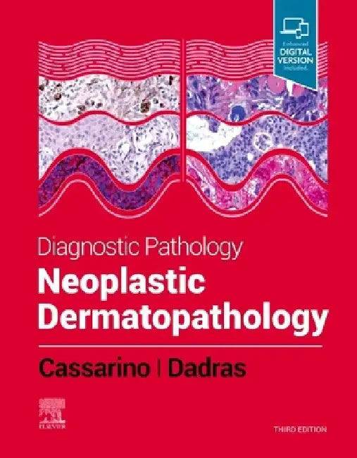 Diagnostic Pathology: Neoplastic Dermatopathology by David S. Cassarino