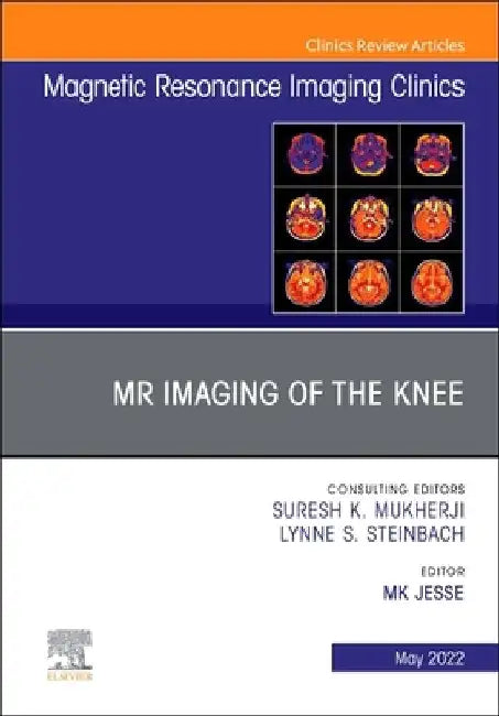 MR Imaging of the Knee, an Issue of Magnetic Resonance Imaging Clinics of North America, 30 by Mary K. Jesse