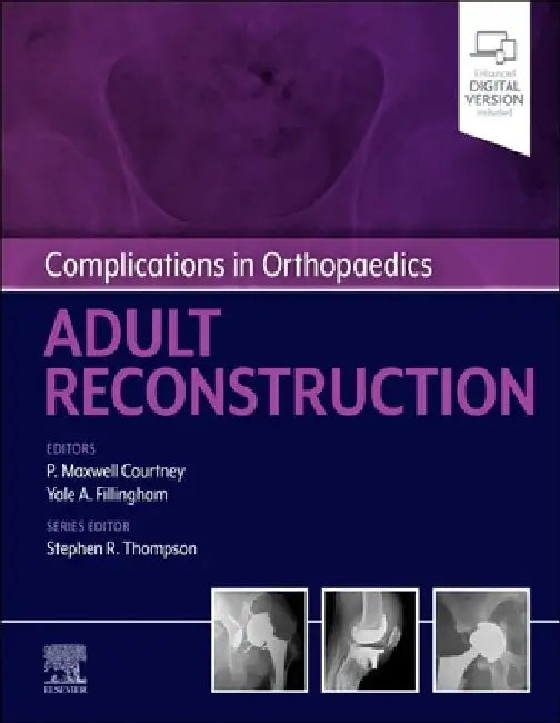 Complications in Orthopaedics: Adult Reconstruction by Paul Maxwell Courtney