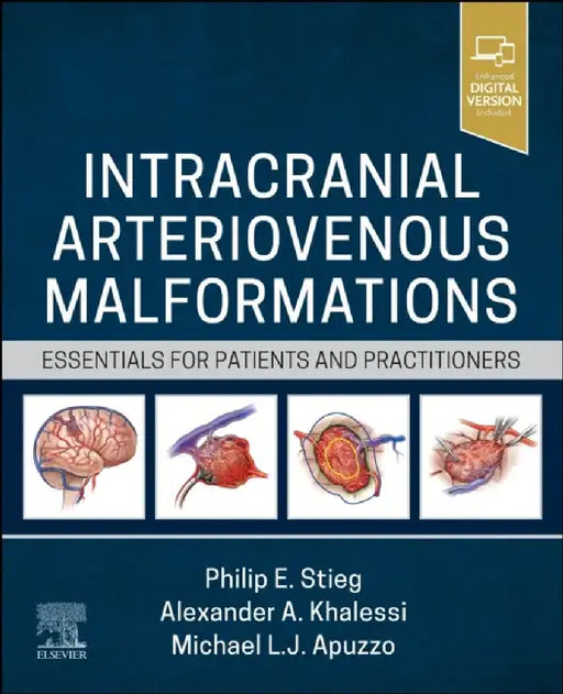 Intracranial Arteriovenous Malformations: Essentials for Patients and Practitioners by Philip E. Stieg