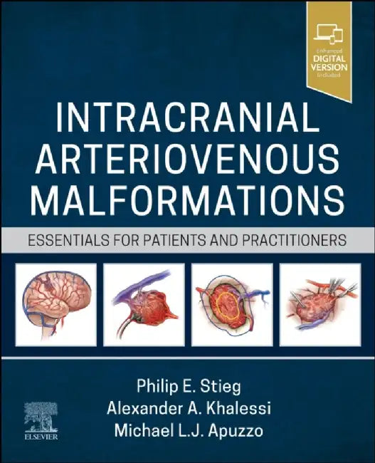 Intracranial Arteriovenous Malformations: Essentials for Patients and Practitioners by Philip E. Stieg