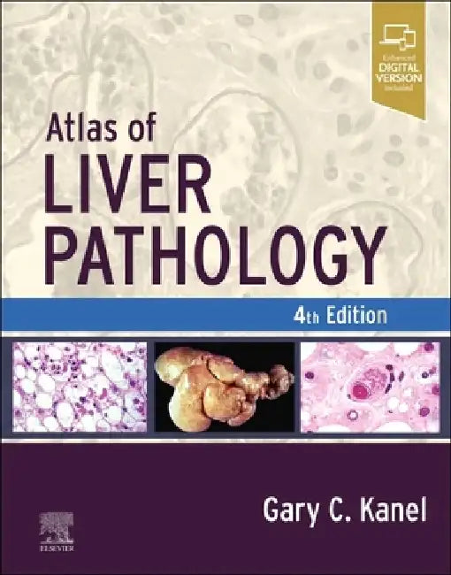 Atlas of Liver Pathology by Gary C. Kanel