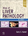 Atlas of Liver Pathology by Gary C. Kanel