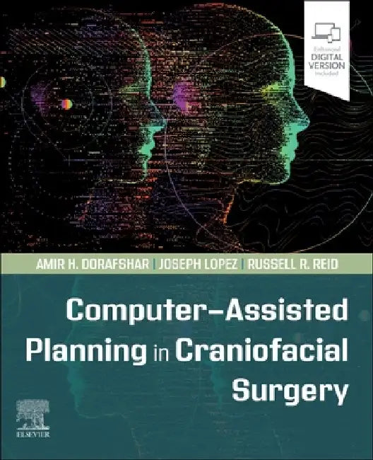 Computer-Assisted Planning in Craniofacial Surgery by Amir H. Dorafshar