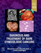 Diagnosis and Treatment of Rare Gynecologic Cancers by Michael Frumovitz