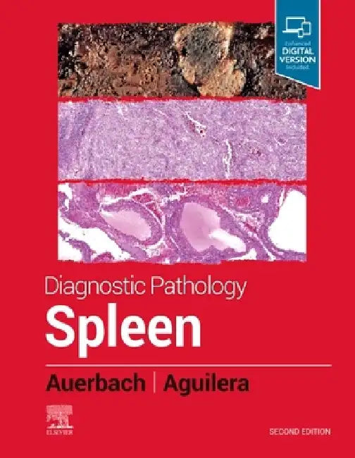Diagnostic Pathology: Spleen by Aaron Auerbach