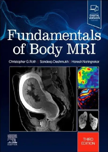 Fundamentals of Body MRI by Christopher G. Roth