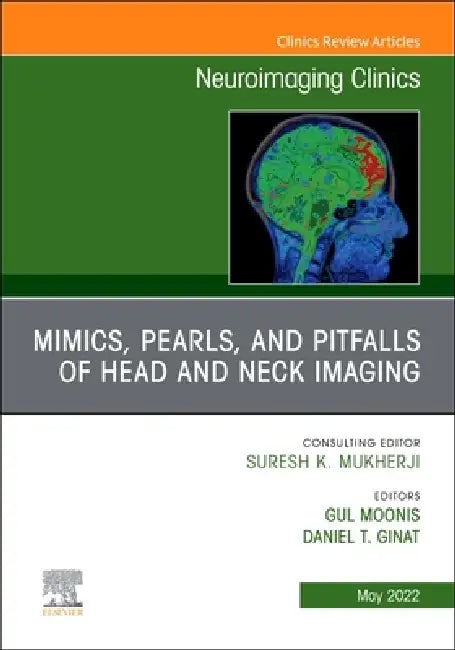 Mimics, Pearls and Pitfalls of Head & Neck Imaging, an Issue of Neuroimaging Clinics of North America: Volume 32-2 by Gul Moonis, Daniel T. Ginat
