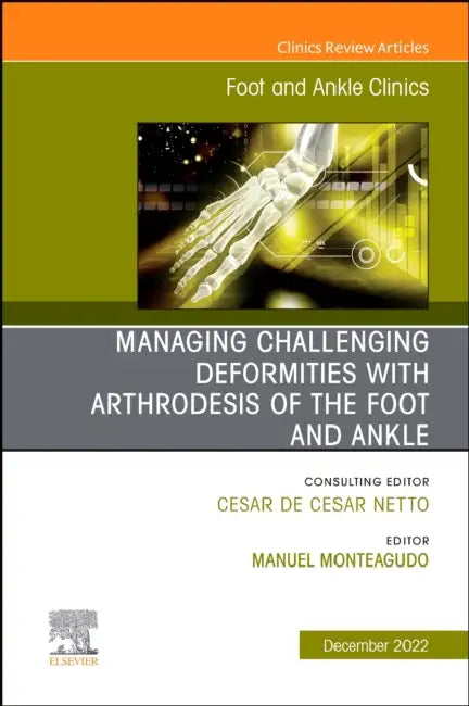 Managing Challenging Deformities with Arthrodesis of the Foot and Ankle, an Issue of Foot and Ankle Clinics of North America: Volume 27-4 by Manuel Monteagudo