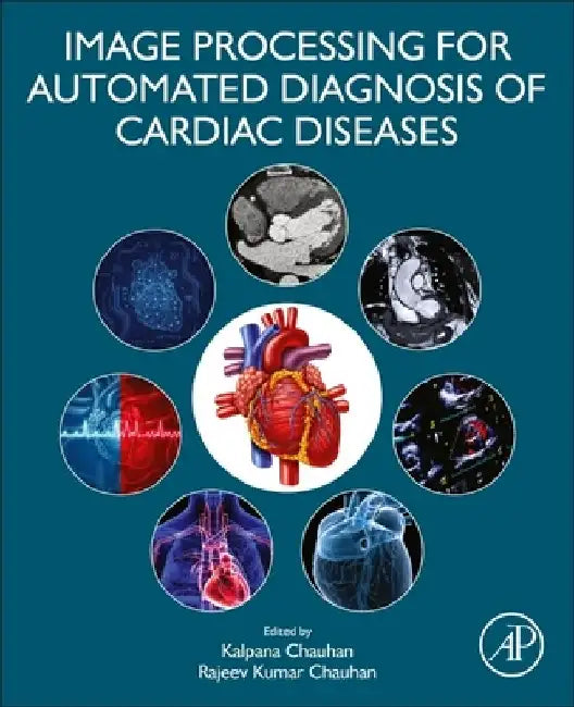 Image Processing for Automated Diagnosis of Cardiac Diseases by Kalpana Chauhan