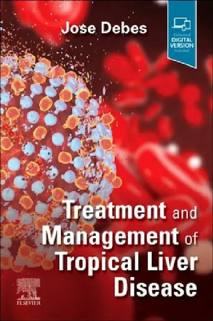 Treatment and Management of Tropical Liver Disease by Jose Debes