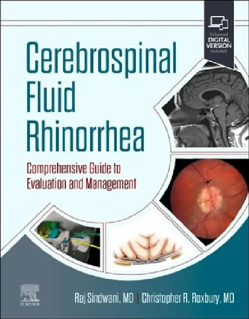 Cerebrospinal Fluid Rhinorrhea: Comprehensive Guide to Evaluation and Management by Raj Sindwani