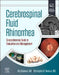 Cerebrospinal Fluid Rhinorrhea: Comprehensive Guide to Evaluation and Management by Raj Sindwani