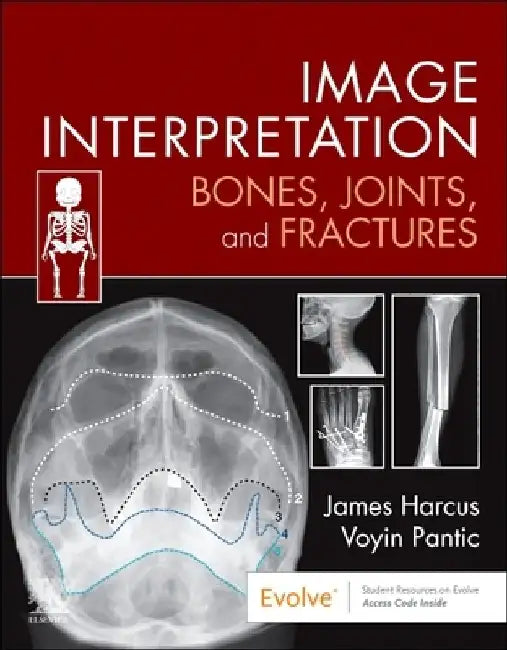 Image Interpretation: Bones, Joints, and Fractures by James Harcus