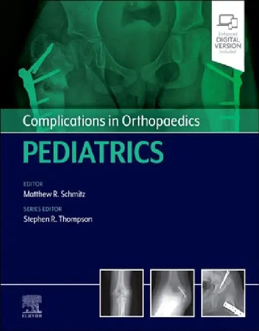 Complications in Orthopaedics: Pediatrics by Matthew Schmitz