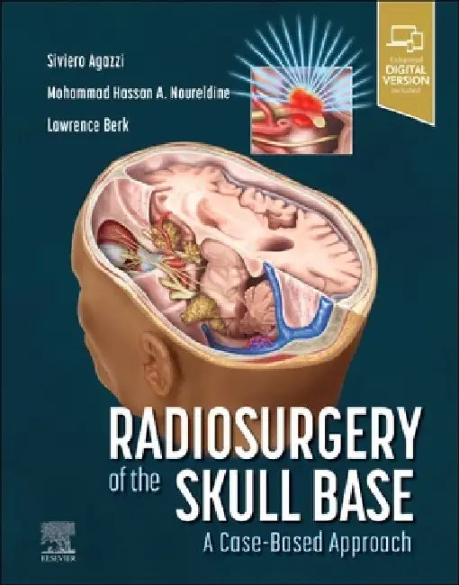 Radiosurgery of the Skull Base: A Case-Based Approach by Siviero Agazzi