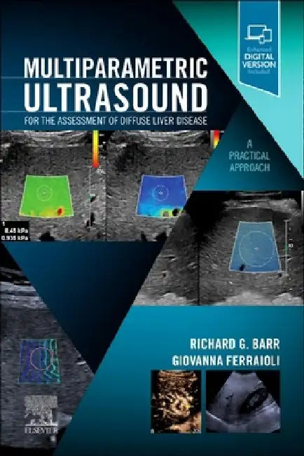 Multiparametric Ultrasound for the Assessment of Diffuse Liver Disease: A Practical Approach by Richard G. Barr