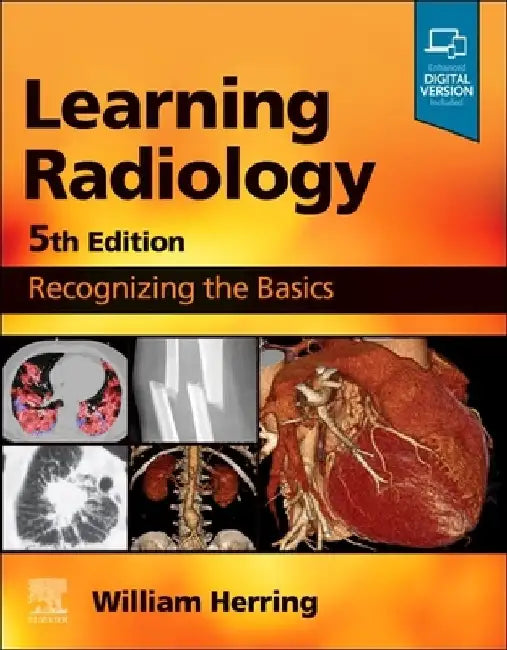 Learning Radiology: Recognizing the Basics by William Herring