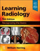 Learning Radiology: Recognizing the Basics by William Herring