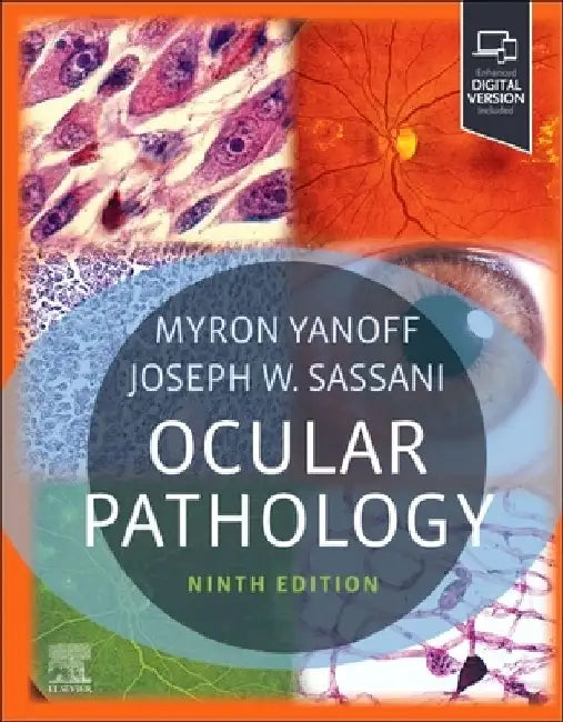 Ocular Pathology by Myron Yanoff