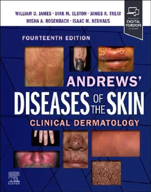 Andrews' Diseases of the Skin: Clinical Dermatology by William D., MD (Emeritus Professor of Dermatology, Department of Dermatology, Perelman School of Medicine, University of Pennsylvania, Philadelphia, Pennsylvania, USA) James