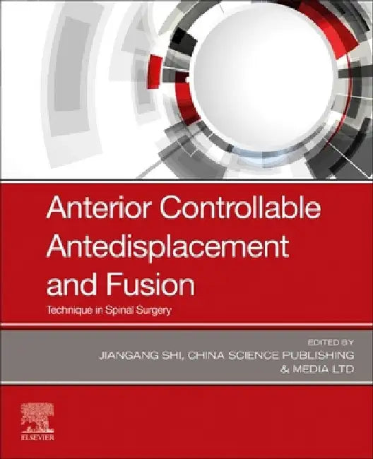Anterior Controllable Antedisplacement and Fusion: Technique in Spinal Surgery by Jiangang Shi