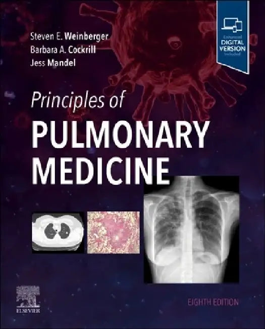 Principles of Pulmonary Medicine by Steven E. Weinberger