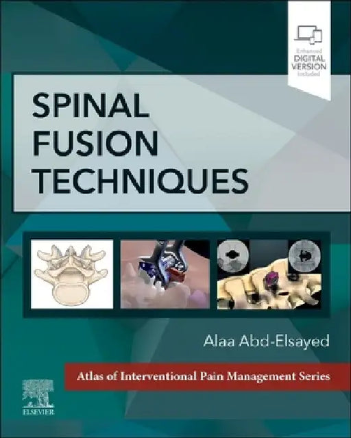 Spinal Fusion Techniques by Alaa Abd-Elsayed